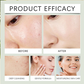 Odświeżająca i nawilżająca woda oczyszczająca do skóry – usuwa sebum z twarzy