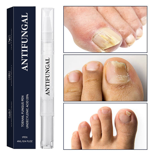 🔥Narzędzie w kształcie długopisu do leczenia grzybicy paznokci (odpowiednie dla paznokci zniszczonych)